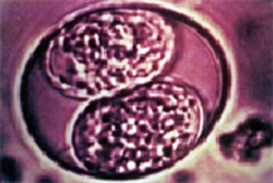 coccidiosis coccidiosis What are Coccidia?